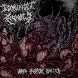 Congenital Anomalies : Human Embryonic Mutilation